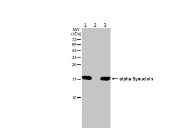 Western blot - Anti-Alpha-synuclein antibody (AB155038)