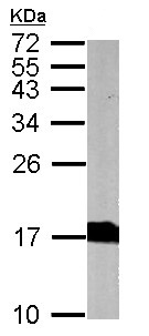 Western blot - Anti-Alpha-synuclein antibody (AB155038), expandable thumbnail