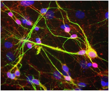 Immunocytochemistry/ Immunofluorescence - Anti-Alpha-synuclein antibody (AB190376), expandable thumbnail