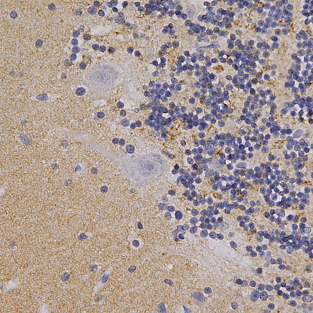 Immunohistochemistry (Formalin/PFA-fixed paraffin-embedded sections) - Anti-Alpha-synuclein antibody (AB190376), expandable thumbnail