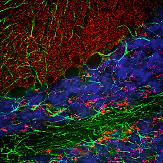 Immunohistochemistry (Formalin/PFA-fixed paraffin-embedded sections) - Anti-Alpha-synuclein antibody (AB190376), expandable thumbnail