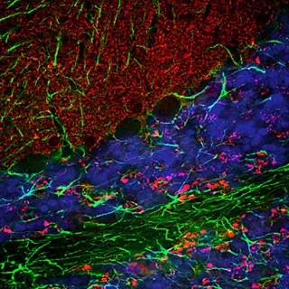 Immunohistochemistry (Formalin/PFA-fixed paraffin-embedded sections) - Anti-Alpha-synuclein antibody (AB190376)