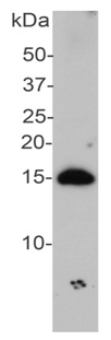 Western blot - Anti-Alpha-synuclein antibody (AB190376), expandable thumbnail