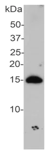 Western blot - Anti-Alpha-synuclein antibody (AB190376)