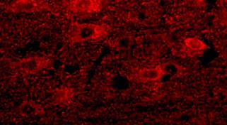 Immunohistochemistry (Formalin/PFA-fixed paraffin-embedded sections) - Anti-Alpha-synuclein antibody (AB216672), expandable thumbnail