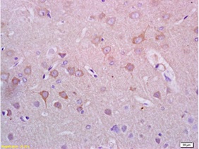 Immunohistochemistry (Formalin/PFA-fixed paraffin-embedded sections) - Anti-Alpha-synuclein antibody (AB216672), expandable thumbnail