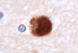 Immunohistochemistry (Formalin/PFA-fixed paraffin-embedded sections) - Anti-Alpha-synuclein antibody (AB21976), expandable thumbnail