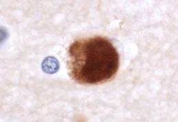 Immunohistochemistry (Formalin/PFA-fixed paraffin-embedded sections) - Anti-Alpha-synuclein antibody (AB21976)