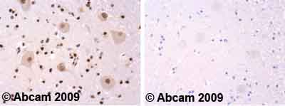 Immunohistochemistry (Formalin/PFA-fixed paraffin-embedded sections) - Anti-Alpha-synuclein antibody (AB52168), expandable thumbnail