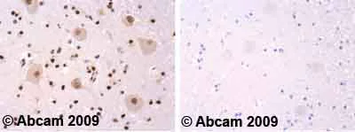 Immunohistochemistry (Formalin/PFA-fixed paraffin-embedded sections) - Anti-Alpha-synuclein antibody (AB52168)