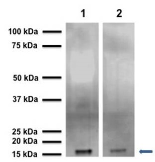 Western blot - Anti-Alpha-synuclein antibody (AB6162), expandable thumbnail