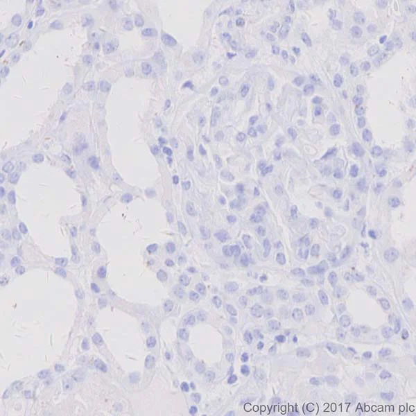 Immunohistochemistry (Formalin/PFA-fixed paraffin-embedded sections) - Anti-Alpha-synuclein antibody [EPR20535] (AB212184)