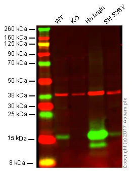 Western blot - Anti-Alpha-synuclein antibody [EPR20535] (AB212184)