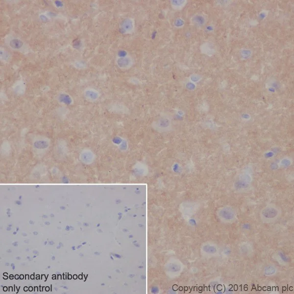 Immunohistochemistry (Formalin/PFA-fixed paraffin-embedded sections) - Anti-Alpha-synuclein antibody [EPR20535] - BSA and Azide free (AB225866)