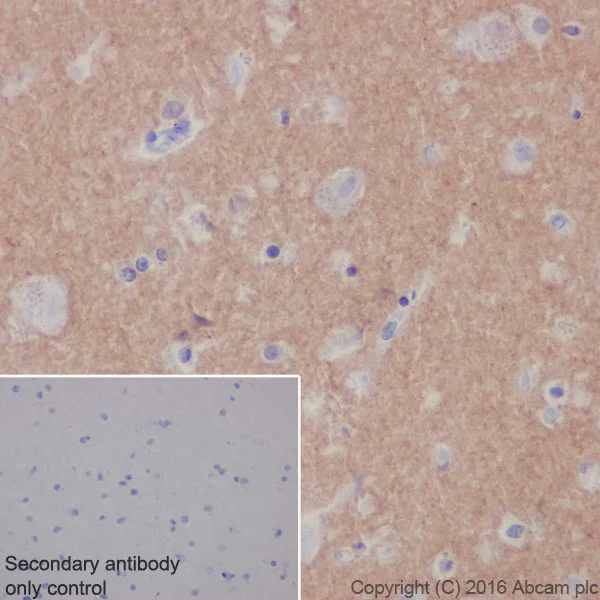 Immunohistochemistry (Formalin/PFA-fixed paraffin-embedded sections) - Anti-Alpha-synuclein antibody [EPR20535] - BSA and Azide free (AB225866)