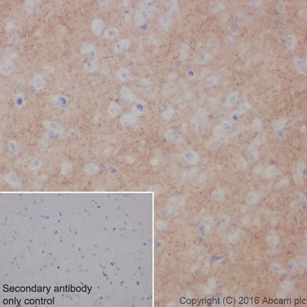 Immunohistochemistry (Formalin/PFA-fixed paraffin-embedded sections) - Anti-Alpha-synuclein antibody [EPR20535] - BSA and Azide free (AB225866)
