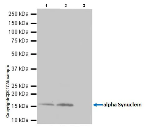 Immunoprecipitation - Anti-Alpha-synuclein antibody [EPR20535] - BSA and Azide free (AB225866)