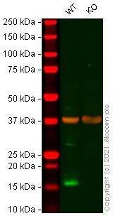 Western blot - Anti-Alpha-synuclein antibody [EPR20535] - BSA and Azide free (AB225866)