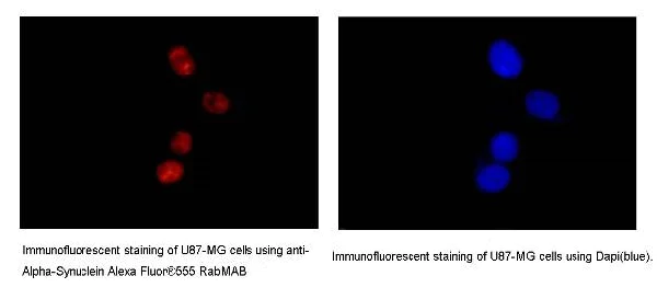 Immunocytochemistry/ Immunofluorescence - Anti-Alpha-synuclein antibody [MJFR1] (AB138501)