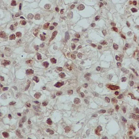 Immunohistochemistry (Formalin/PFA-fixed paraffin-embedded sections) - Anti-Alpha-synuclein antibody [MJFR1] (AB138501)