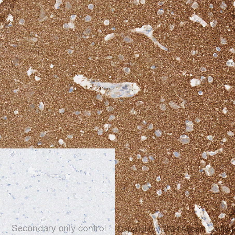 Immunohistochemistry - Anti-Alpha-synuclein antibody [MJFR1] (ab138501), expandable thumbnail