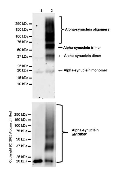 Western blot - Anti-Alpha-synuclein antibody [MJFR1] (AB138501)