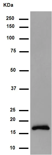 Western blot - Anti-Alpha-synuclein antibody [MJFR1] (AB138501)