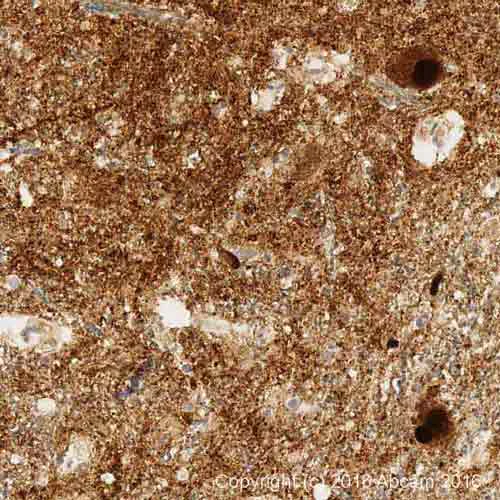 Immunohistochemistry (Formalin/PFA-fixed paraffin-embedded sections) - Anti-Alpha-synuclein antibody [MJFR1] - BSA and Azide free (AB209420)