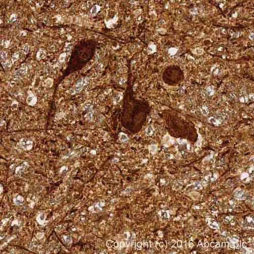 Immunohistochemistry (Formalin/PFA-fixed paraffin-embedded sections) - Anti-Alpha-synuclein antibody [MJFR1] - BSA and Azide free (AB209420)