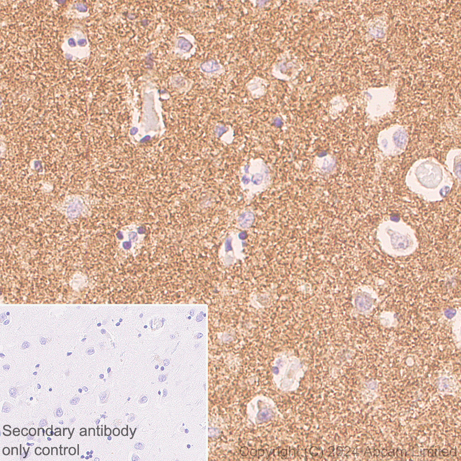 Immunohistochemistry (Formalin/PFA-fixed paraffin-embedded sections) - Anti-Alpha-synuclein antibody [MJFR1] - Chicken IgY (Chimeric) (AB320839), expandable thumbnail