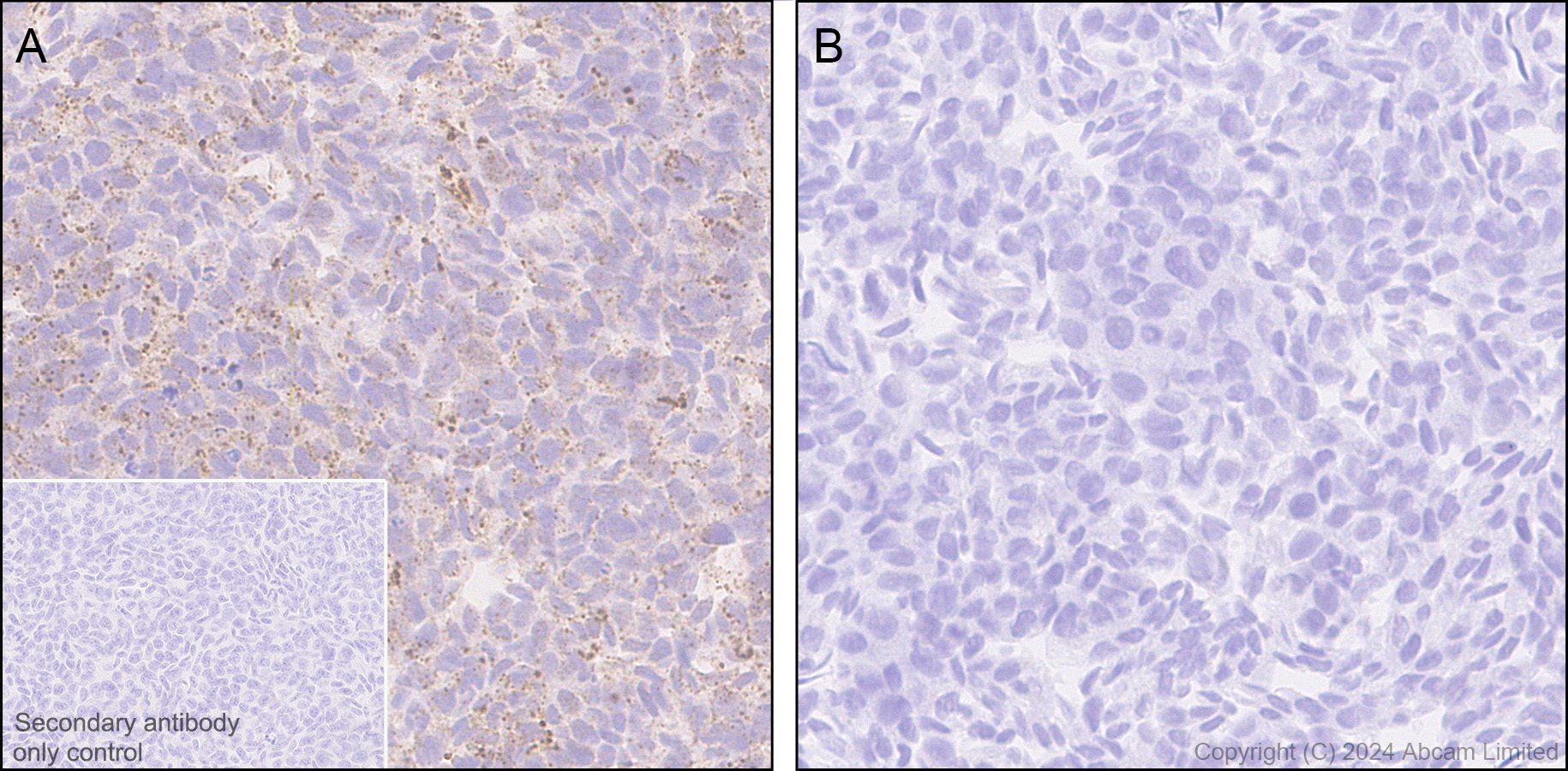 Immunohistochemistry (Formalin/PFA-fixed paraffin-embedded sections) - Anti-Alpha-synuclein antibody [MJFR1] - Chicken IgY (Chimeric) (AB320839), expandable thumbnail