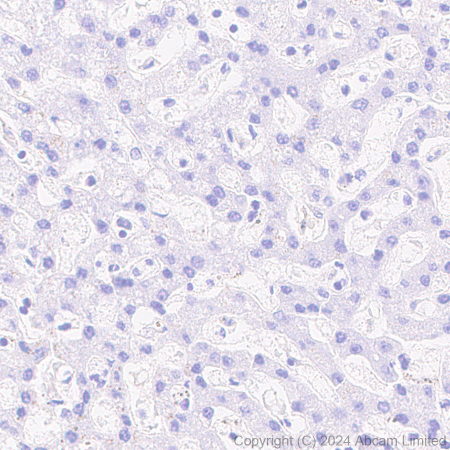 Immunohistochemistry (Formalin/PFA-fixed paraffin-embedded sections) - Anti-Alpha-synuclein antibody [MJFR1] - Chicken IgY (Chimeric) (AB320839), expandable thumbnail