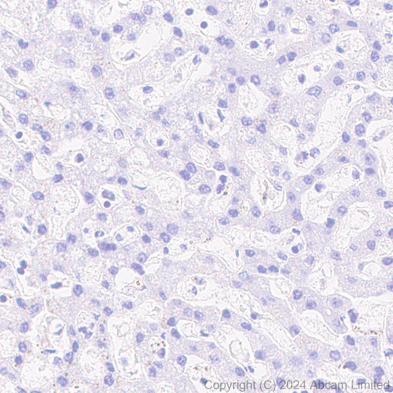 Immunohistochemistry (Formalin/PFA-fixed paraffin-embedded sections) - Anti-Alpha-synuclein antibody [MJFR1] - Chicken IgY (Chimeric) (AB320839)