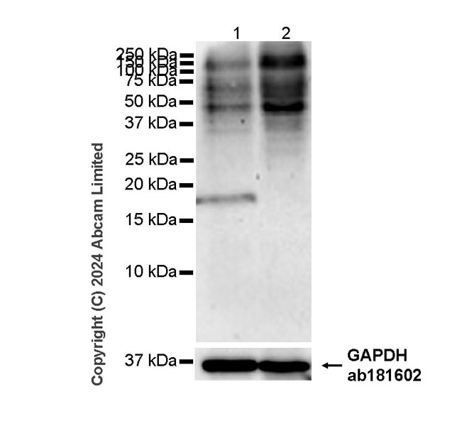 Western blot - Anti-Alpha-synuclein antibody [MJFR1] - Chicken IgY (Chimeric) (AB320839), expandable thumbnail