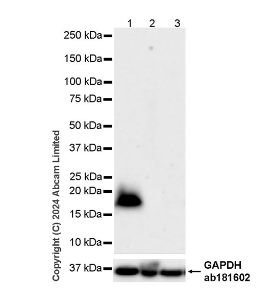 Western blot - Anti-Alpha-synuclein antibody [MJFR1] - Chicken IgY (Chimeric) (AB320839), expandable thumbnail