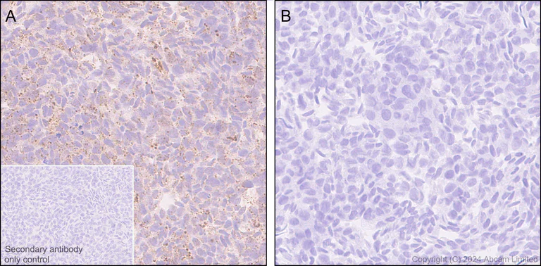 Immunohistochemistry (Formalin/PFA-fixed paraffin-embedded sections) - Anti-Alpha-synuclein antibody [MJFR1] - Chicken IgY (Chimeric) - BSA and Azide free (AB320840)