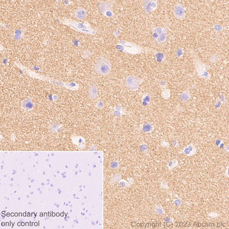 Immunohistochemistry (Formalin/PFA-fixed paraffin-embedded sections) - Anti-Alpha-synuclein antibody [MJFR1] - Mouse IgG2a (Chimeric) - BSA and Azide free (AB309158)