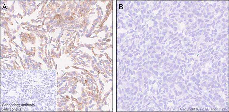 Immunohistochemistry (Formalin/PFA-fixed paraffin-embedded sections) - Anti-Alpha-synuclein antibody [MJFR1] - Mouse IgG2a (Chimeric) - BSA and Azide free (AB309158)