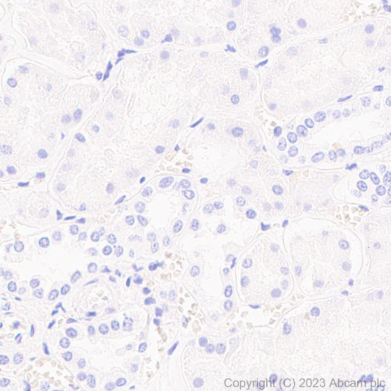 Immunohistochemistry (Formalin/PFA-fixed paraffin-embedded sections) - Anti-Alpha-synuclein antibody [MJFR1] - Mouse IgG2a (Chimeric) - BSA and Azide free (AB309158)