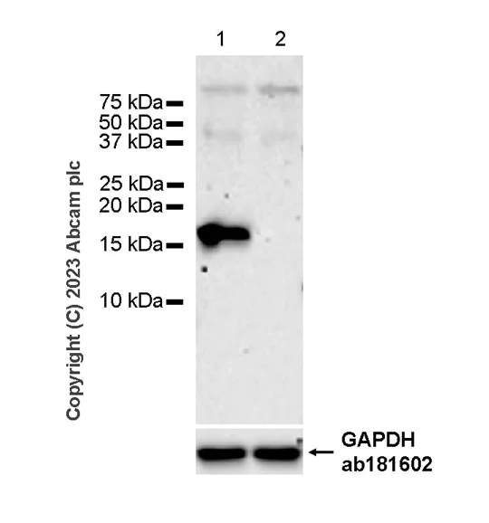 Western blot - Anti-Alpha-synuclein antibody [MJFR1] - Mouse IgG2a (Chimeric) - BSA and Azide free (AB309158)