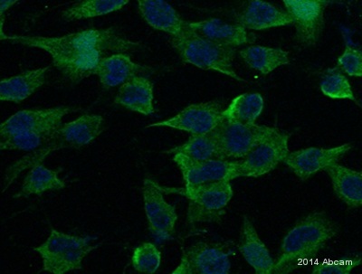 Immunocytochemistry/ Immunofluorescence - Alpha Synuclein Antibody Sampler Panel (AB263465), expandable thumbnail