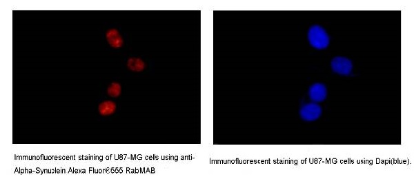 Immunocytochemistry/ Immunofluorescence - Alpha Synuclein Antibody Sampler Panel (AB263465), expandable thumbnail