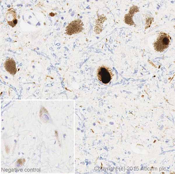 Immunohistochemistry (Formalin/PFA-fixed paraffin-embedded sections) - Alpha Synuclein Antibody Sampler Panel (ab263465), expandable thumbnail