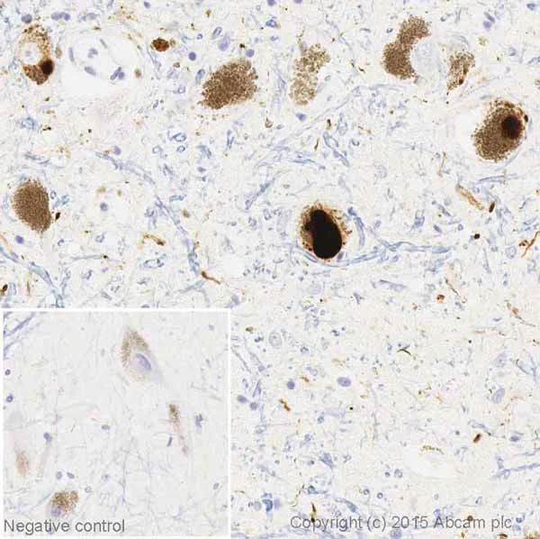Alpha Synuclein抗体Sampler Panel (ab263465)| Abcam中文官网