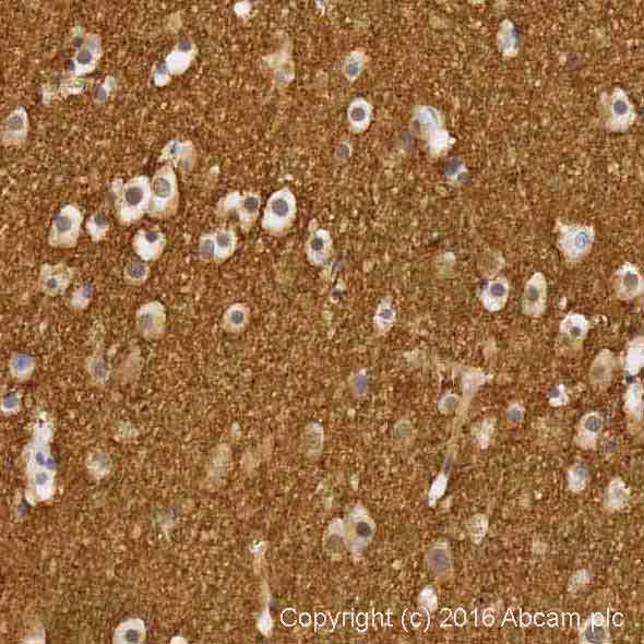 Immunohistochemistry (Formalin/PFA-fixed paraffin-embedded sections) - Alpha Synuclein Antibody Sampler Panel (AB263465), expandable thumbnail