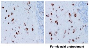 Immunohistochemistry (Formalin/PFA-fixed paraffin-embedded sections) - Alpha Synuclein Antibody Sampler Panel (ab263465), expandable thumbnail