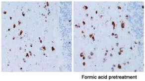 Immunohistochemistry (Formalin/PFA-fixed paraffin-embedded sections) - Alpha Synuclein Antibody Sampler Panel (AB263465)