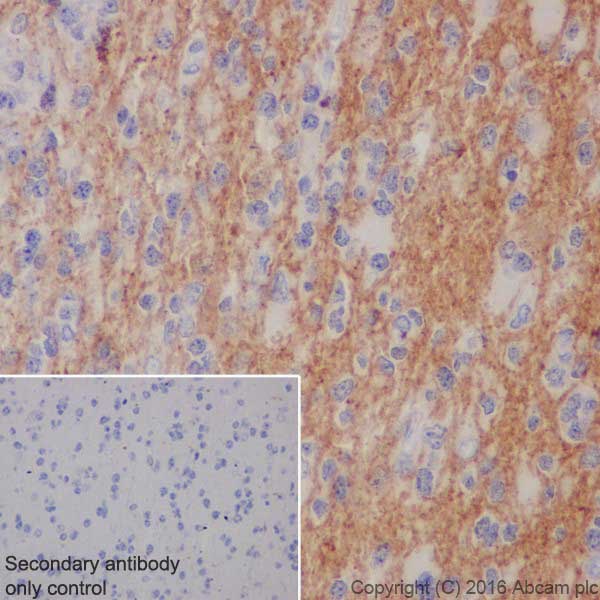 Immunohistochemistry (Formalin/PFA-fixed paraffin-embedded sections) - Alpha Synuclein Antibody Sampler Panel (AB263465), expandable thumbnail