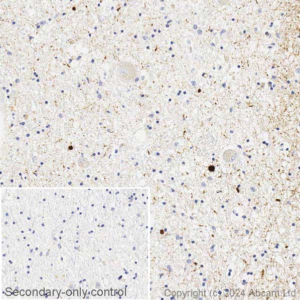 Immunohistochemistry (Formalin/PFA-fixed paraffin-embedded sections) - Anti-Alpha-synuclein antibody [syn211] - BSA and Azide free (AB206675), expandable thumbnail