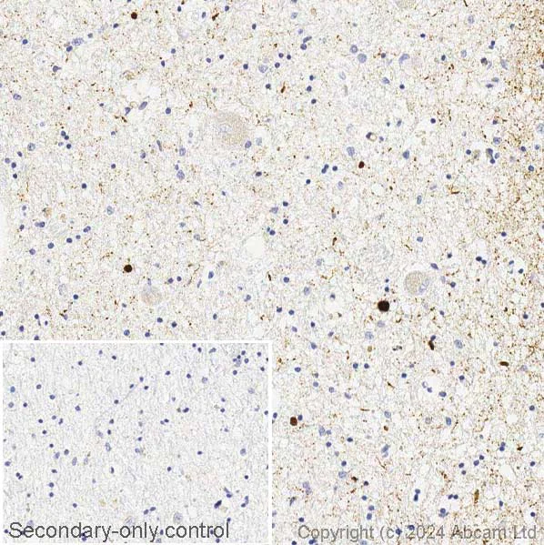 Immunohistochemistry (Formalin/PFA-fixed paraffin-embedded sections) - Anti-Alpha-synuclein antibody [syn211] - BSA and Azide free (AB206675)